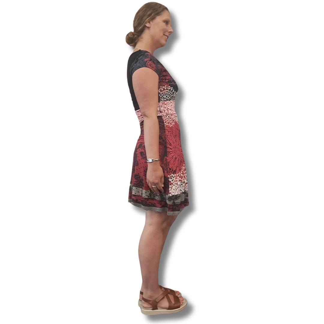Desigual - Myrcella Dress - Side View